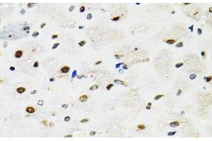 Immunohistochemistry of paraffin-embedded Rat brain using SFPQ Polyclonal Antibody at dilution of 1:100 (40x lens). (SFPQ 抗体)