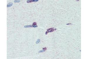 Immunohistochemistry (IHC) image for anti-PR Domain Containing 9 (PRDM9) (Middle Region) antibody (ABIN2774963) (PRDM9 抗体  (Middle Region))