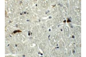 Immunohistochemical staining of mouse brain cells with RABGEF1 polyclonal antibody  at 5 ug/mL. (RABGEF1 抗体  (Internal Region))