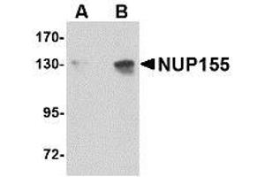 Image no. 1 for anti-Nucleoporin 155kDa (NUP155) (C-Term) antibody (ABIN342687) (NUP155 抗体  (C-Term))