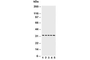 Western Blotting (WB) image for anti-Caspase 6, Apoptosis-Related Cysteine Peptidase (CASP6) (AA 24-44) antibody (ABIN3030313)