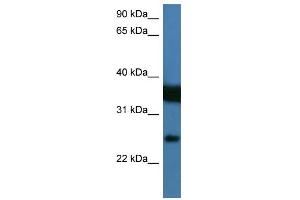 Western Blotting (WB) image for anti-Zinc Finger, Matrin Type 2 (ZMAT2) (N-Term) antibody (ABIN2776637)
