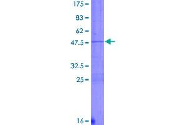 DYNC1H1 Protein (AA 1-197) (GST tag)