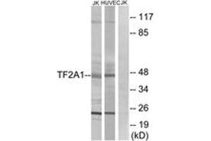 Western blot analysis of extracts from Jurkat/HuvEc cells, using TF2A1 Antibody. (GTF2A1 抗体  (AA 281-330))