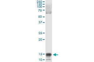 Immunoprecipitation of NFATC2IP transfected lysate using anti-NFATC2IP monoclonal antibody and Protein A Magnetic Bead , and immunoblotted with NFATC2IP MaxPab rabbit polyclonal antibody.