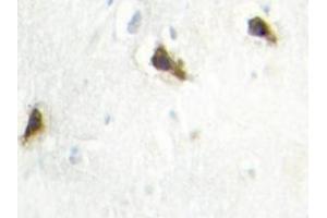 Image no. 2 for anti-Histidyl-tRNA Synthetase (HARS1) antibody (ABIN272164) (HARS1/Jo-1 抗体)