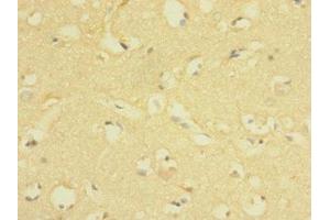 Immunohistochemistry of paraffin-embedded human brain tissue using ABIN7158206 at dilution of 1:100 (Lrig1 抗体  (AA 35-220))