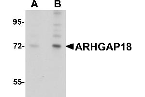 Western Blotting (WB) image for anti-rho GTPase Activating Protein 18 (ARHGAP18) (C-Term) antibody (ABIN1030254) (ARHGAP18 抗体  (C-Term))
