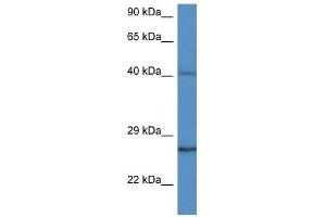 Western Blot showing CCS antibody used at a concentration of 1 ug/ml against MDA-MB-435S Cell Lysate (Superoxide dismutase copper chaperone 抗体  (C-Term))