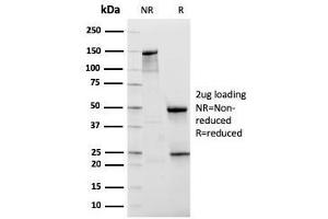 SDS-PAGE Analysis Purified NKX3. (NKX3-1 抗体  (AA 92-224))