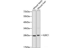 Western blot analysis of extracts of various cell lines using KLRC1 Polyclonal Antibody at dilution of 1:1000. (KLRC1 抗体)