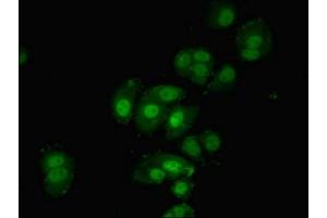 Immunofluorescent analysis of MCF-7 cells using ABIN7142338 at dilution of 1:100 and Alexa Fluor 488-congugated AffiniPure Goat Anti-Rabbit IgG(H+L) (PDPK1 抗体  (AA 277-556))