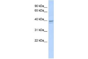 RRM2 antibody used at 1 ug/ml to detect target protein. (RRM2 抗体  (N-Term))