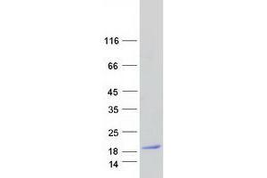 Western Blotting (WB) image for Myelin and Lymphocyte Protein, T Cell Differentiation Protein (MAL) (Transcript Variant A) protein (Myc-DYKDDDDK Tag) (ABIN2725234)