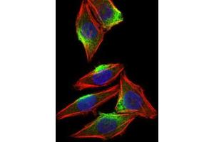Immunohistochemistry (IHC) image for anti-Calcium/calmodulin-Dependent Protein Kinase IV (CAMK4) (AA 35-292) antibody (ABIN1845379)
