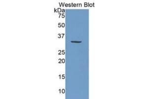WB of Protein Standard: different control antibodies against Highly purified E. (PML ELISA 试剂盒)