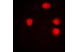 Immunofluorescent analysis of ELF5 staining in HuvEc cells. (ELF5 抗体  (C-Term))