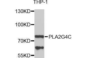 Western blot analysis of extracts of THP-1 cells, using PLA2G4C antibody. (PLA2G4C 抗体)