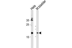 Western Blotting (WB) image for anti-Family with Sequence Similarity 159, Member A (FAM159A) antibody (ABIN3004605) (FAM159A 抗体)