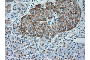 Immunohistochemical staining of paraffin-embedded Kidney tissue using anti-SERPINA1mouse monoclonal antibody. (SERPINA1 抗体)