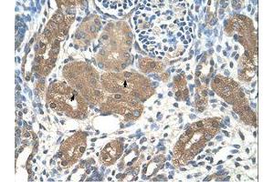 Image no. 1 for anti-Acid Phosphatase 1, Soluble (ACP1) (AA 21-70) antibody (ABIN203506) (ACP1 抗体  (AA 21-70))
