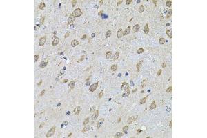 Immunohistochemistry of paraffin-embedded mouse brain using NFU1 Antibody. (NFU1 抗体  (AA 1-230))