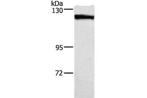 Western Blot analysis of Human tongue cancer tissue using DSG1 Polyclonal Antibody at dilution of 1:750 (Desmoglein 1 抗体)