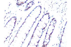 Immunohistochemistry of paraffin-embedded human colon using PRPF8 Rabbit mAb (ABIN7269737) at dilution of 1:100 (40x lens). (PRPF8 抗体)
