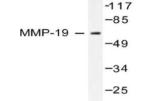 Image no. 2 for anti-Matrix Metallopeptidase 19 (MMP19) antibody (ABIN265528) (MMP19 抗体)