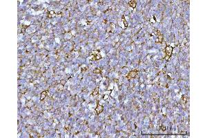 IHC analysis of RUFY4 using anti-RUFY4 antibody (ABIN7599475). (RUFY4 抗体  (AA 1-553))