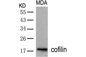 Image no. 2 for anti-Cofilin 1 (CFL1) (AA 1-5), (N-Term) antibody (ABIN197372) (Cofilin 抗体  (N-Term))