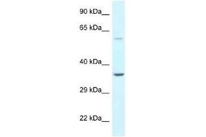 Western Blot showing BAG5 antibody used at a concentration of 1 ug/ml against Hela Cell Lysate (BAG5 抗体  (N-Term))