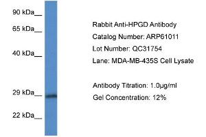Western Blotting (WB) image for anti-Hydroxyprostaglandin Dehydrogenase 15-(NAD) (HPGD) (N-Term) antibody (ABIN2788653) (HPGD 抗体  (N-Term))