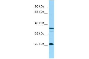 WB Suggested Anti-CD83 Antibody Titration: 1.