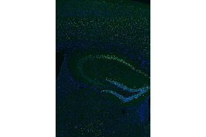 Indirect immunostaining of PFA fixed paraffin embedded mouse hippocampus section (1 : 500; green). (BCL11B 抗体  (AA 1-151))