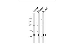 All lanes : Anti-PLB Antibody at 1:2000 dilution Lane 1: human heart lysate Lane 2: mouse heart lysate Lane 3: rat heart lysate Lysates/proteins at 20 μg per lane. (PLB-T17 (AA 1-30) 抗体)