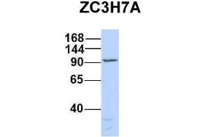 Western Blotting (WB) image for anti-Zinc Finger CCCH-Type Containing 7A (ZC3H7A) (Middle Region) antibody (ABIN2777487)