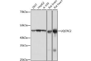 Western blot analysis of extracts of various cell lines, using UQCRC2 Rabbit mAb (ABIN1679334, ABIN3018863, ABIN3018864 and ABIN7101676) at 1:1000 dilution. (UQCRC2 抗体)