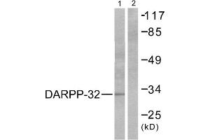Western blot analysis of extracts from 293 cells treated with EGF (200ng/ml, 30min), using DARPP-32 (epitope around residue 75) antibody (ABIN5976153, Line 1 and 2). (DARPP32 抗体  (Thr75))
