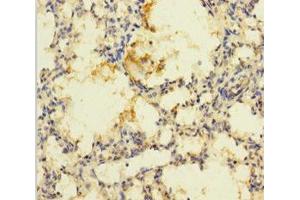 Immunohistochemistry of paraffin-embedded human lung tissue using ABIN7168904 at dilution of 1:100 (PRSS23 抗体  (AA 20-383))