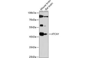 Western blot analysis of extracts of various cell lines, using ATCAY antibody (ABIN7265707) at 1:1000 dilution.