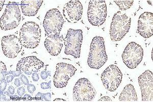 Immunohistochemical analysis of paraffin-embedded mouse testis tissue. (TUBB2A 抗体)