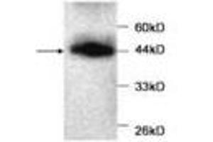 Image no. 1 for anti-Myoglobin (MB) antibody (ABIN791533) (Myoglobin 抗体)