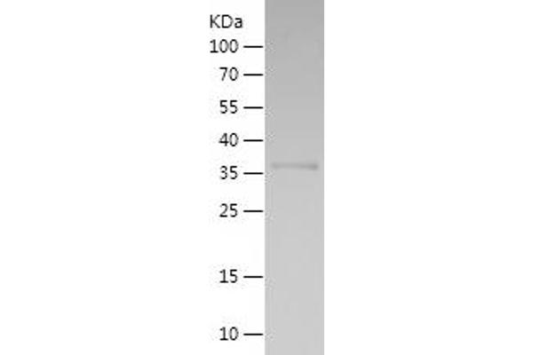 KEAP1 Protein (AA 378-486) (His-IF2DI Tag)