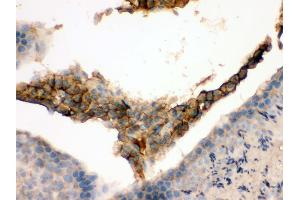 IHC(P): Mouse Testis Tissue