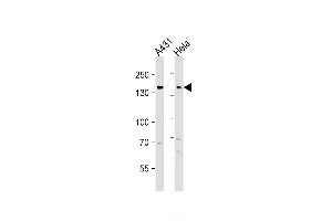 All lanes : Anti-EGFR Antibody (C-term) at 1:1000 dilution Lane 1: A431 whole cell lysate Lane 2: Hela whole cell lysate Lysates/proteins at 20 g per lane. (EGFR 抗体  (C-Term))