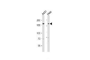 All lanes : Anti-EGFR Antibody (C-term) at 1:1000 dilution Lane 1: A431 whole cell lysate Lane 2: Hela whole cell lysate Lysates/proteins at 20 g per lane.