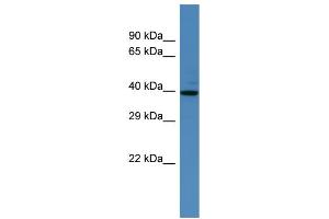 Western Blotting (WB) image for anti-Spermatogenesis Associated 2 (SPATA2) (N-Term) antibody (ABIN2774247) (SPATA2 抗体  (N-Term))