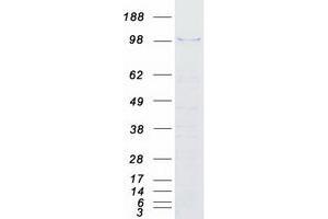 Western Blotting (WB) image for Aspartate beta-Hydroxylase (ASPH) (Transcript Variant 1) protein (Myc-DYKDDDDK Tag) (ABIN2715000)