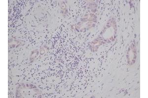 Image no. 2 for anti-KIT Ligand (KITLG) antibody (ABIN465573) (KIT Ligand 抗体)